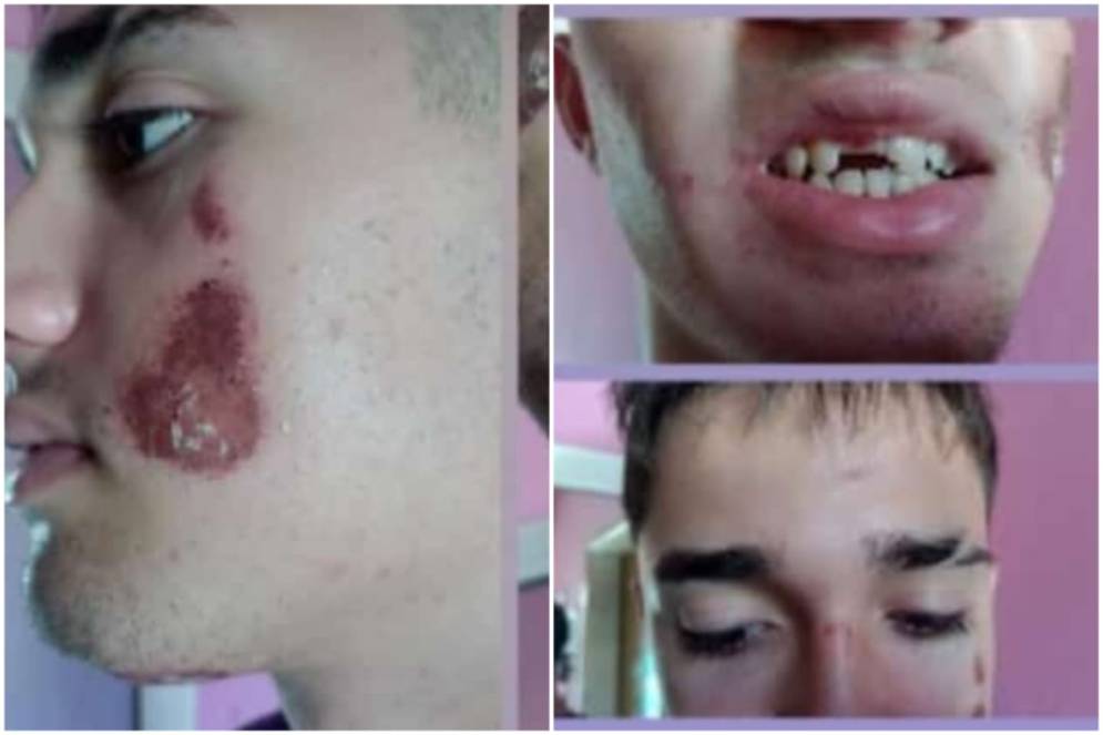 Las lastimaduras en su cara lo dicen todo.