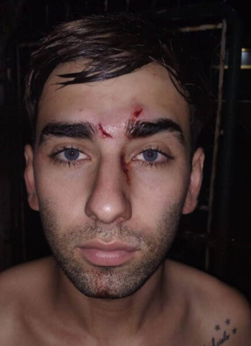 As&iacute; qued&oacute; Mat&iacute;as Mc Cormack, de Atl&eacute;tico. Gentileza: La Palabra de Lobos.