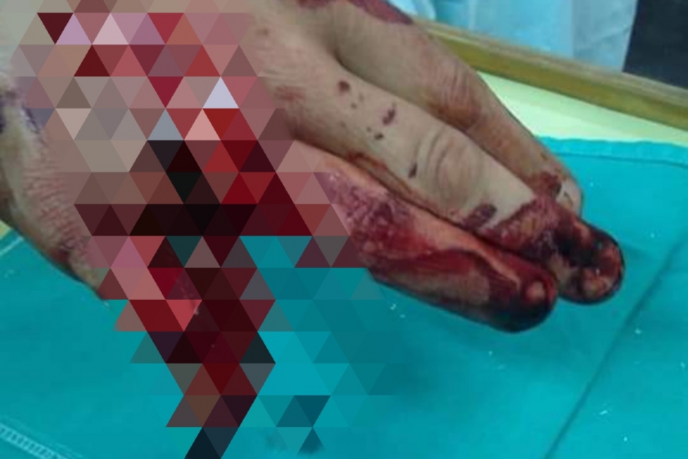 IM&Aacute;GENES SENSIBLES. 