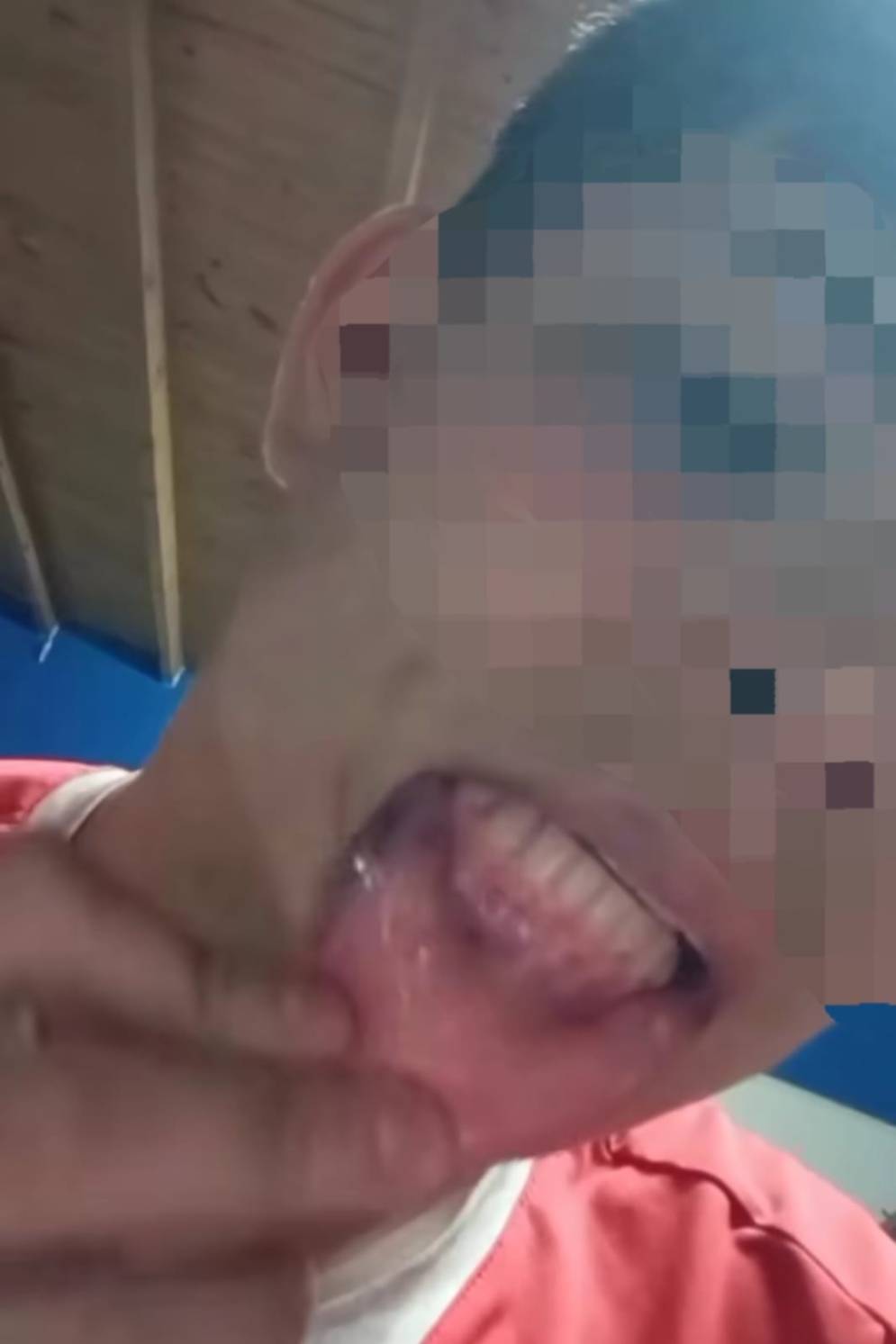 El menor mostr&oacute; las heridas que tiene en la boca y en los ojos.