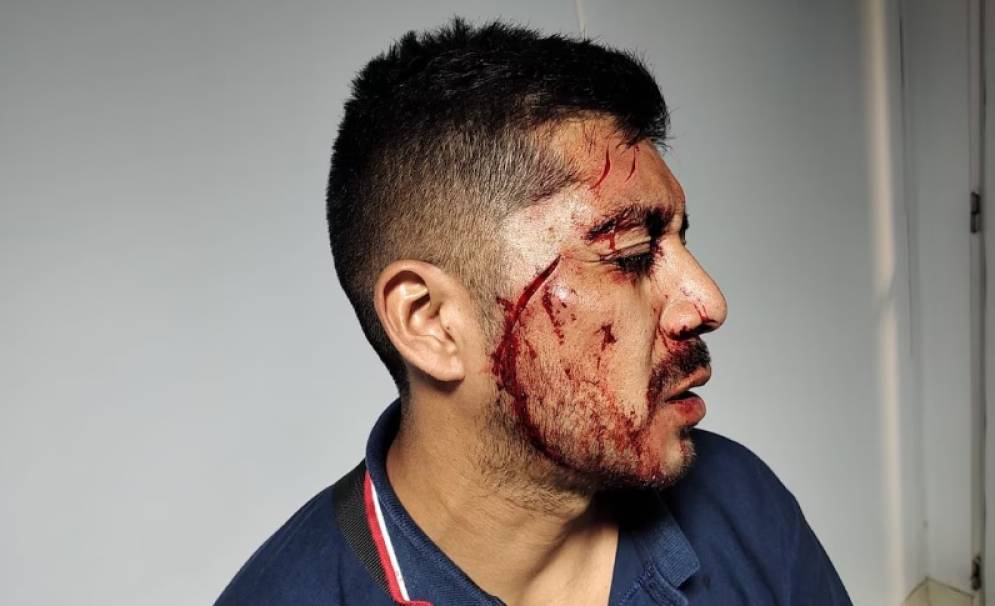 Llama la atenci&oacute;n que no intentaron&nbsp;robar.