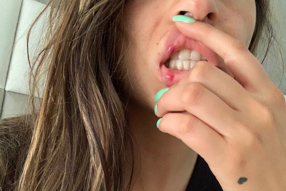 Lesiones en la boca de la v&iacute;ctima despu&eacute;s de una de las agresiones.