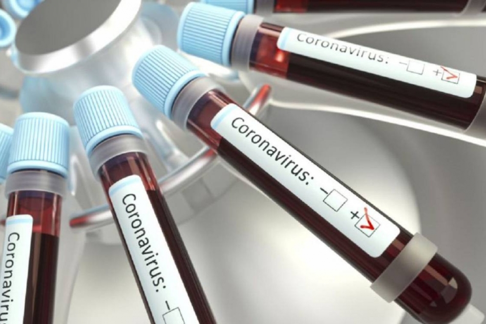 Este mi&eacute;rcoles dieron a conocer tres casos de coronavirus
