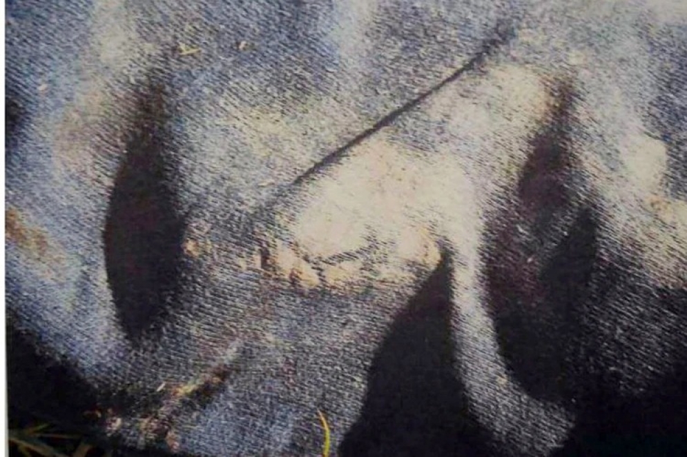 La marca de la rueda en el joggins de la v&iacute;ctima. (FOTO: Infobae).